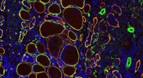 Muscular dystrophy: pathogenesis and therapy - Dr. Stefano Previtali Lab