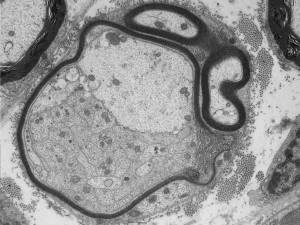 Inherited neuropathies and nerve development - Dr. Stefano Previtali Lab